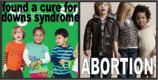 Child Model with Downs Syndrome Meme #8